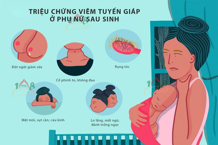 Viêm tuyến giáp sau sinh dễ nhiễm độc, suy giáp - Ảnh minh họa BSCC