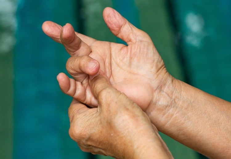Đau ngón tay và gấp duỗi khó - Ảnh minh họa