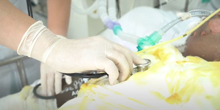 Câu cá ở gần đường dây điện, 3 người bị bỏng nặng toàn thân Câu cá ở gần đường dây điện, 3 người bị bỏng nặng toàn thân