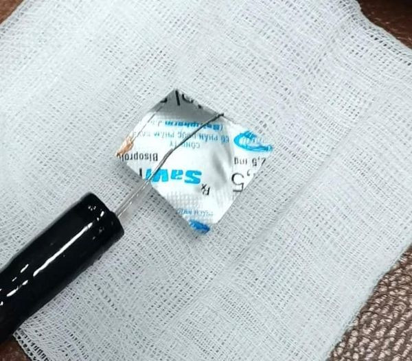 Vỏ thuốc đã được lấy ra thành công - Ảnh BVCC