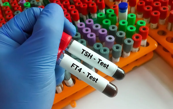 Xét nghiệm kháng thể TRAb có những giá trị gì? - Ảnh minh họa