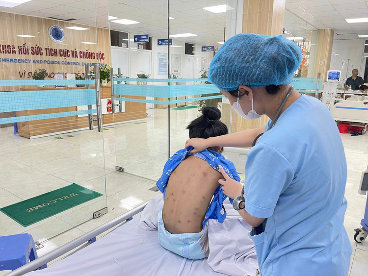 Nhiều trẻ bị sốc phản vệ do ong đốt: Xử lý và phòng tránh thế nào?