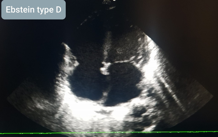 Dị tật tim của trẻ trên phim chụp - ảnh BVCC