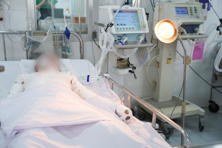 Bệnh nhân bị pháo nổ đa chấn thương và phỏng nghiêm trọng - Ảnh BVCC