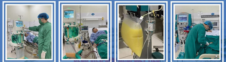 Lọc máu liên tục kèm lọc máu hấp phụ cho người bệnh