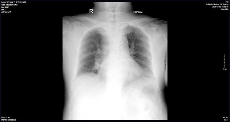 Người bệnh đái tháo đường cần cẩn trọng khi mắc cúm ảnh 1 Người bệnh đái tháo đường cần cẩn trọng khi mắc cúm ảnh 1