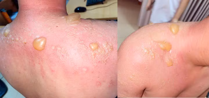 Hình ảnh tổn thương của người bệnh