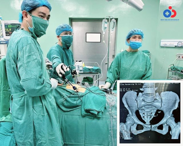 2 người bị dụng cụ tránh thai xuyên thủng ruột ảnh 1