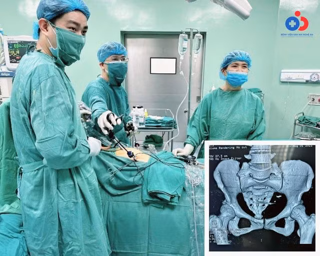 2 người bị dụng cụ tránh thai xuyên thủng ruột ảnh 1