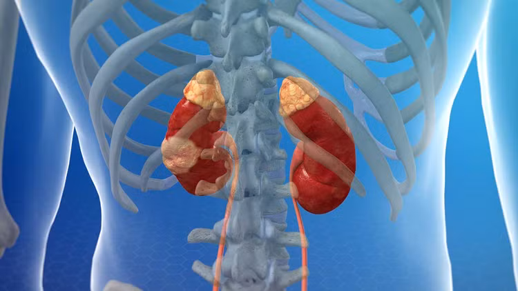 Biểu hiện ung thư thận