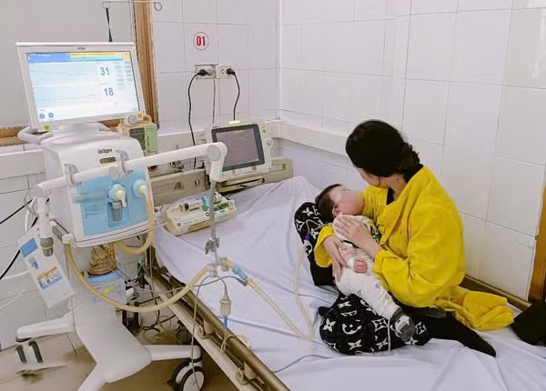 Bệnh nhi 7 tháng bị viêm phổi, suy hô hấp do sởi biến chứng nặng được hỗ trợ thở oxy - Ảnh BVCC