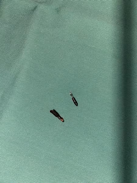 2 dị vật đâm thùng ruột đã được lấy ra thành công - Ảnh BVCC