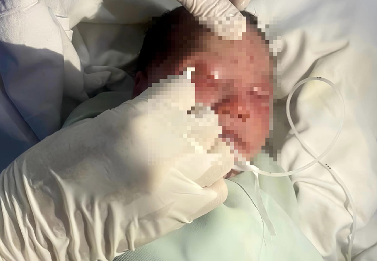 Bác sĩ chăm sóc tổn thương cho bé - Ảnh BVCC