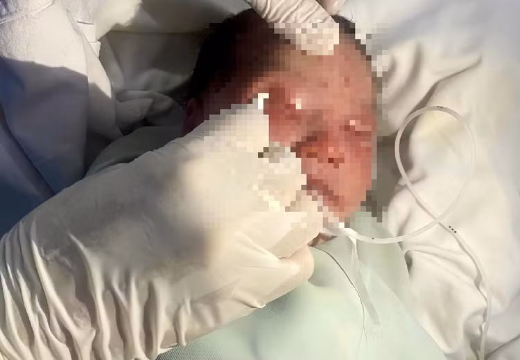 Bác sĩ chăm sóc tổn thương cho bé - Ảnh BVCC