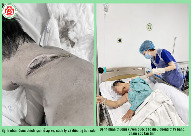 Bệnh nhân bị vi khuẩn ăn thịt người tấn công cổ: Bác sĩ chỉ cách tránh ảnh 1