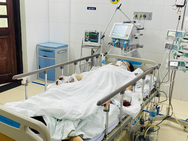 Chơi pháo tự chế, trẻ 16 tuổi chấn thương khắp cơ thể ảnh 1