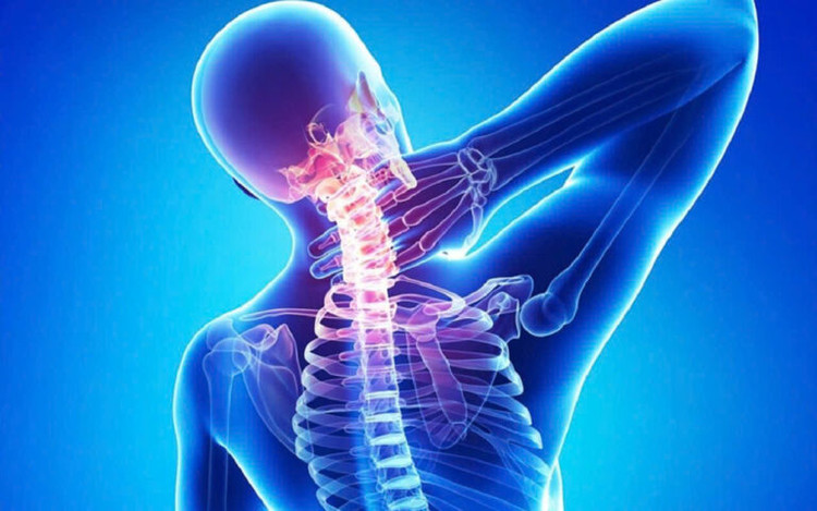 Thoái hóa cột sống cổ là một trong những nguyên nhân phổ biến gây đau cổ vai gáy - Ảnh minh họa