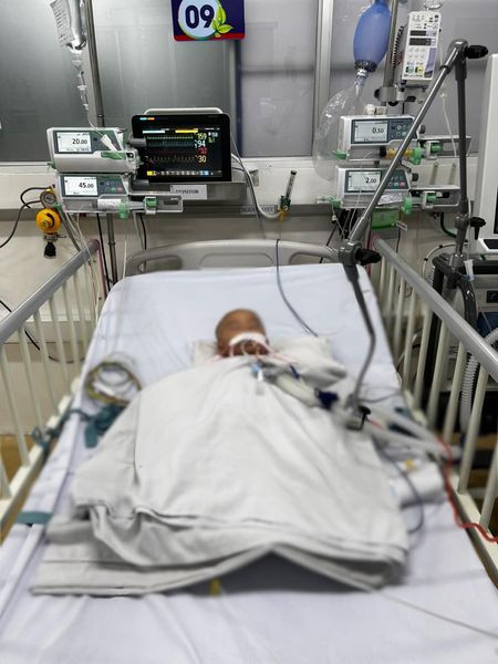 Bé bị amip ăn não được điều trị tích cực - Ảnh BVCC