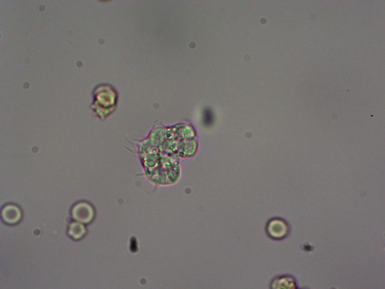 Amip - Ảnh minh họa