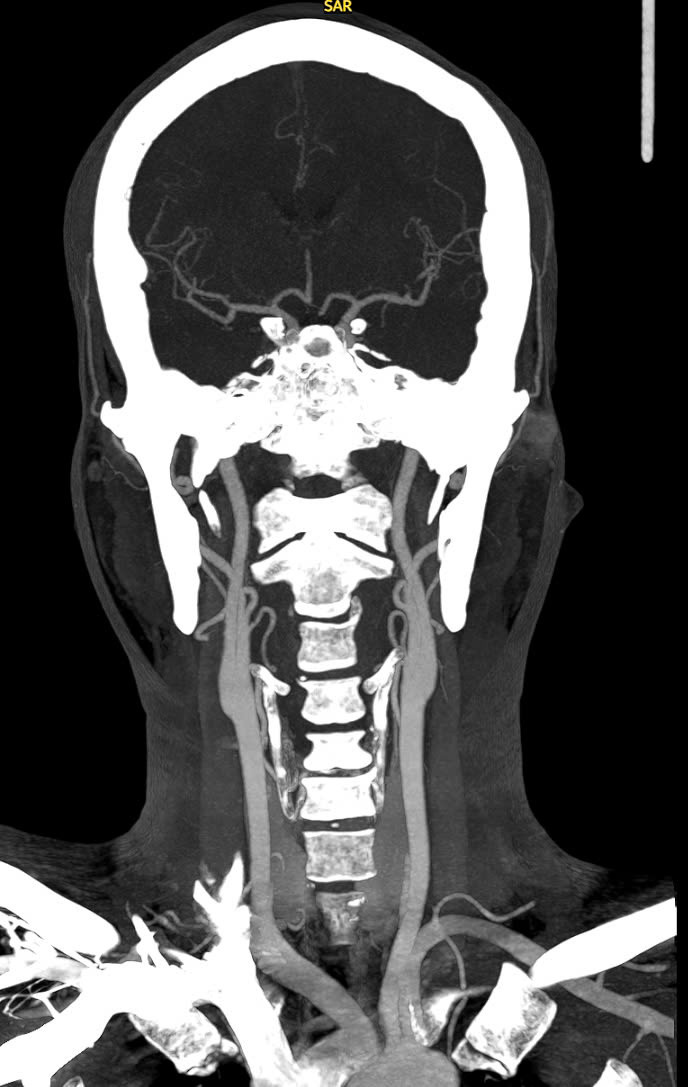 Đang chơi phòng khách bất ngờ đột quỵ, tưởng không qua khỏi, phục hồi ngoạn mục ảnh 2