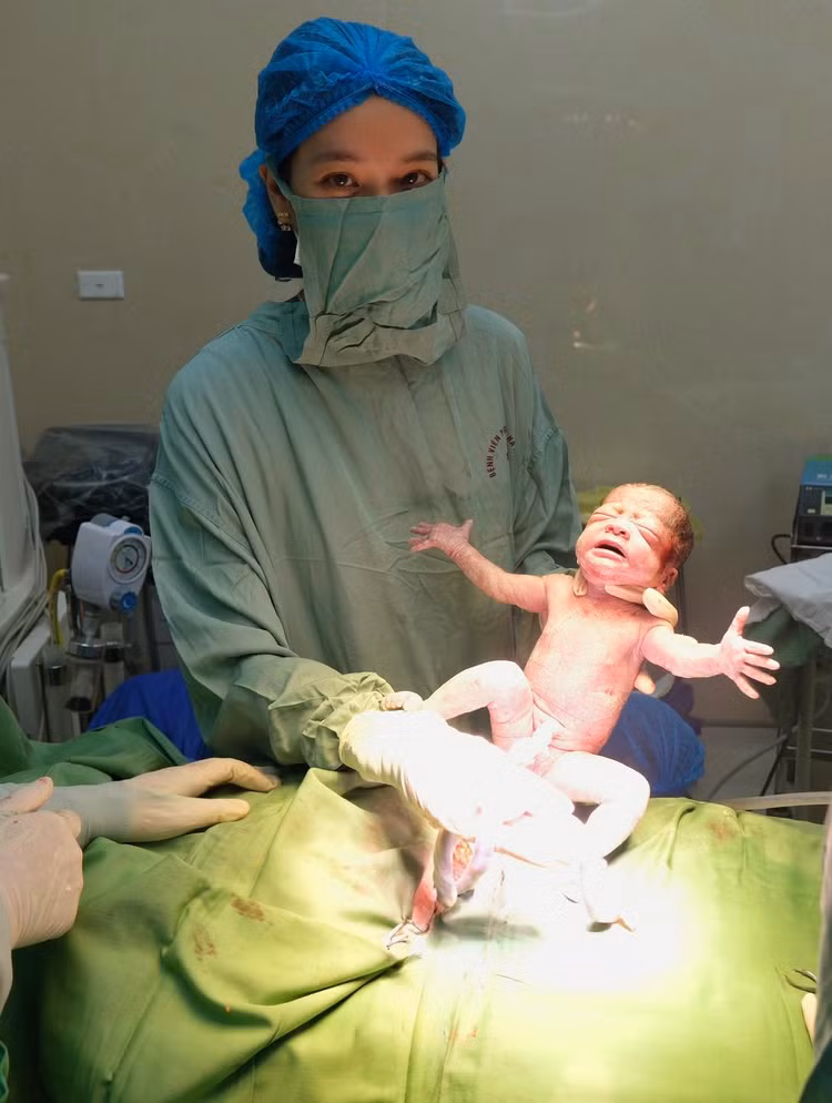 Bé bị dây rốn thắt nút - Ảnh BVCC