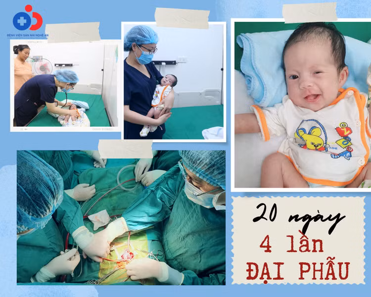 4 lần đại phẫu trong 20 ngày đầu đời cứu trẻ nặng 2,5 kg ảnh 1