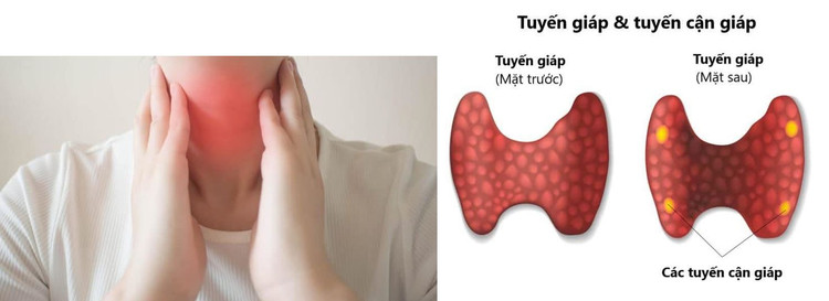 Tuyến giáp và tuyến cận giáp - Ảnh minh họa BSCC