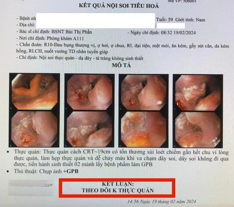 Kết quả nội soi bệnh nhân được chẩn đoán ung thư thực quản - Ảnh BVCC