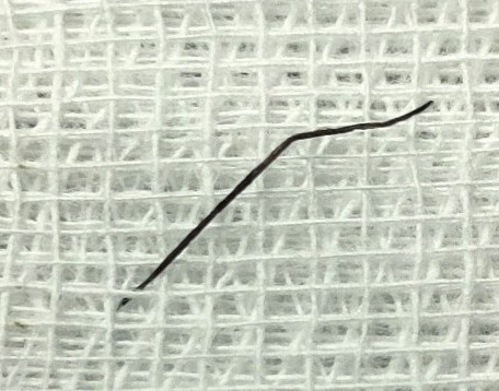 Chiếc ghim dài 2 cm đã được lấy ra - Ảnh BVCC