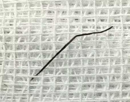 Chiếc ghim dài 2 cm đã được lấy ra - Ảnh BVCC