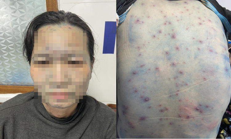 Tình trạng bệnh nhân V.T.O trước khi nhập viện