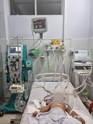 Nhiều ca tay chân miệng nguy kịch - Ảnh BVCC