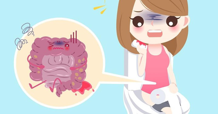 Xuất huyết tiêu hóa ở trẻ em thường có nhiều biểu hiện như nôn ra máu, đi ngoài phân đen hoặc phân máu.