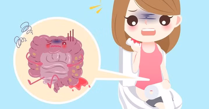 Xuất huyết tiêu hóa ở trẻ em thường có nhiều biểu hiện như nôn ra máu, đi ngoài phân đen hoặc phân máu.