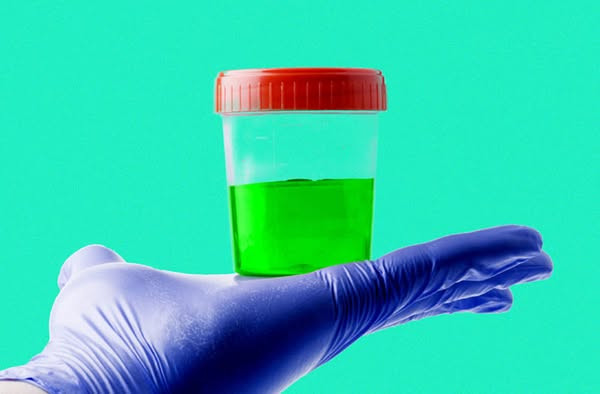 Tránh dùng kháng sinh bừa bãi hoặc bệnh nhân ra nhà thuốc kể bệnh và được bán cho một combo thuốc khiến nước tiểu màu xanh - Ảnh BSCC