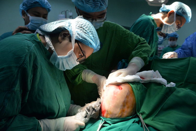 Bác sĩ thực hiện lấy da vùng đầu bệnh nhân - Ảnh BVCC