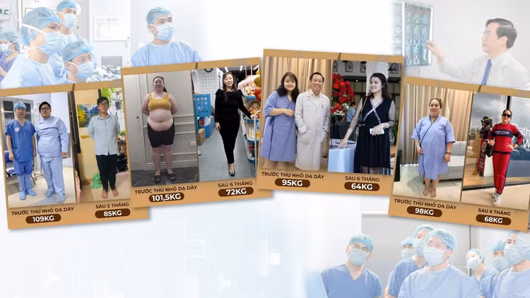 Một số người giảm cân sau phẫu thuật thu nhỏ dạ dày giảm béo - Ảnh BSCC
