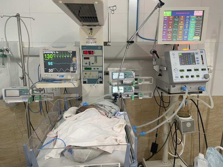 Cứu trẻ 39 ngày tuổi ngưng thở do nhiễm virus hợp bào hô hấp ảnh 1