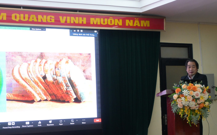 90% người nhiễm nấm phổi còn sót ngoài cộng đồng: Nguy cơ tử vong rất cao ảnh 3