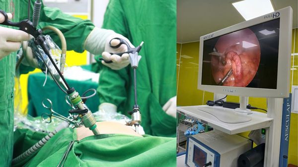 Ca phẫu thuật cho bệnh nhân - Ảnh BVCC