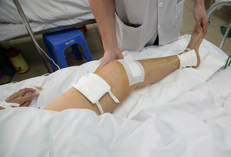 Bác sĩ khoa Chấn thương chỉnh hình hướng dẫn tập phục hồi chức năng chân cho bệnh nhân B.