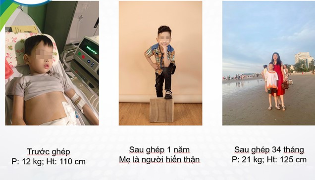 Việc ghép thận thành công ở trẻ em cải thiện nhiều bệnh lý ở trẻ, giúp phát triển giới tính, thay đổi nhận thức và tâm lý xã hội của trẻ