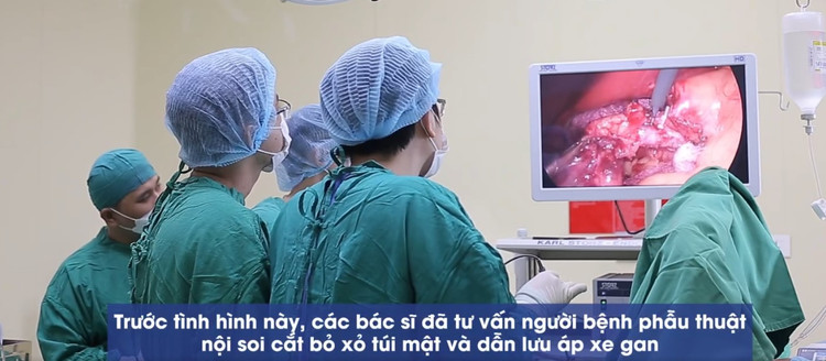 Nội soi cắt bỏ sỏi túi mật và dẫn lưu áp xe gan cho bệnh nhân - Ảnh BVCC