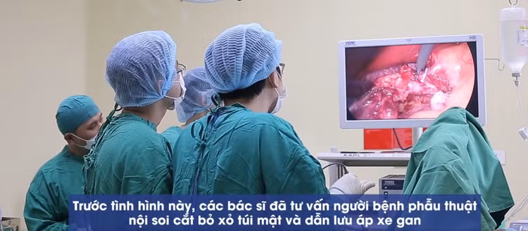 Nội soi cắt bỏ sỏi túi mật và dẫn lưu áp xe gan cho bệnh nhân - Ảnh BVCC