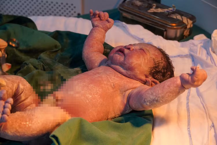 Em bé cân nặng 4,1 kg đã ra đời khỏe mạnh - Ảnh BVCC