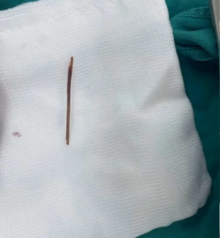 Cụ ông 77 tuổi phải cắt gan vì thói quen người Việt thường mắc ảnh 4