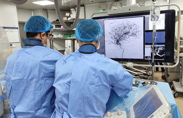 Người bệnh được chỉ định can thiệp mạch não dưới sự hỗ trợ của hệ thống chụp mạch máu số hóa xóa nền (DSA).