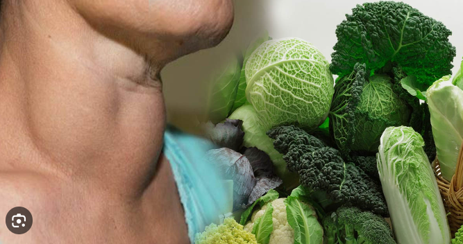 Chuyên gia mách loại u tuyến giáp nào cần kiêng rau cải