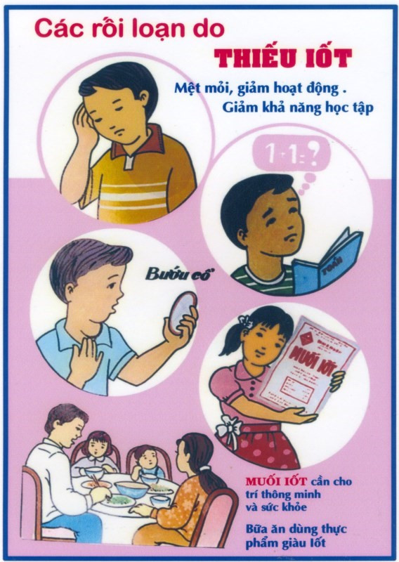 Các rối loạn do thiếu i ốt - Ảnh minh họa