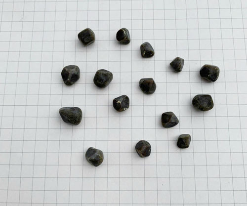 Sỏi túi mật của người bệnh - Ảnh: BVCC